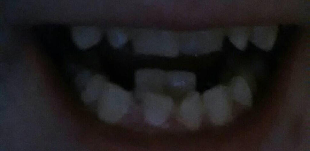 teeth_weirdness__by_savantiromero-d8n8qw